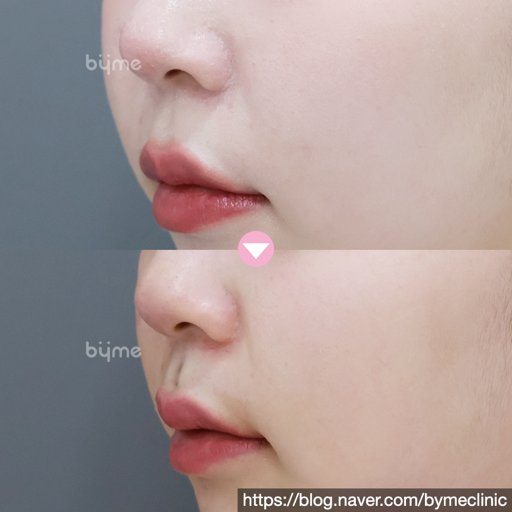 SE-ce9b5037-db8f-49dc-a6e3-7d17d6470c9a.jpg
