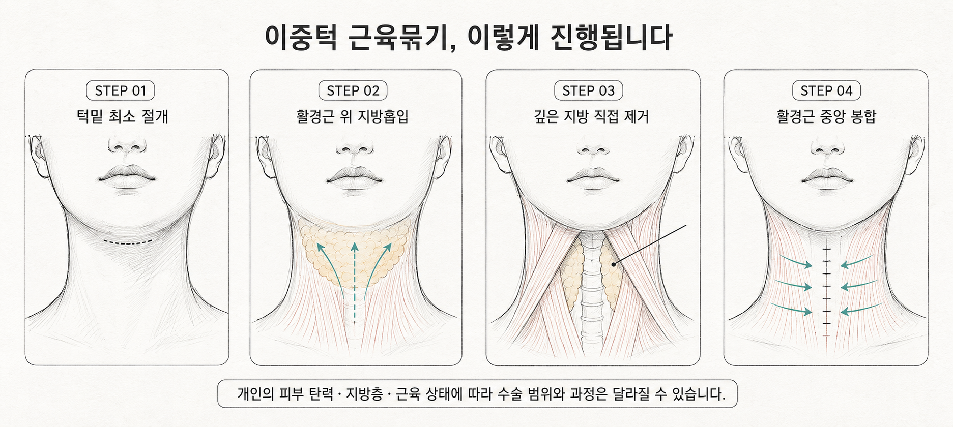 Codex 이미지 2026년 8월 21일 오전 11_52_31.png