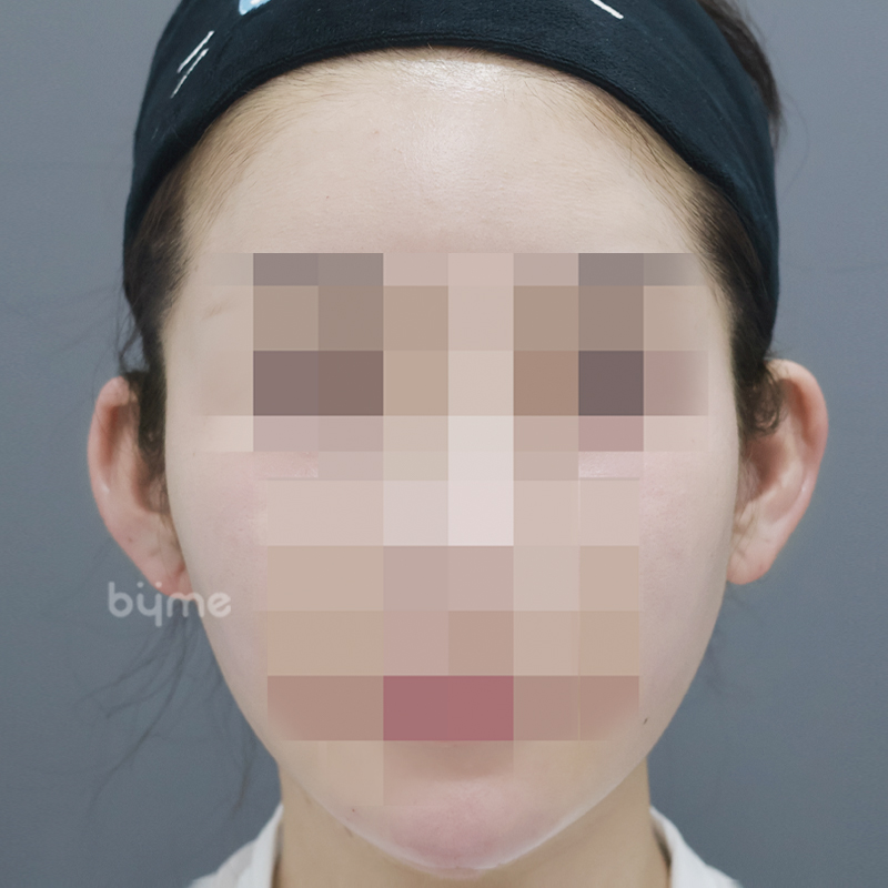 김지영_후 (1).jpg