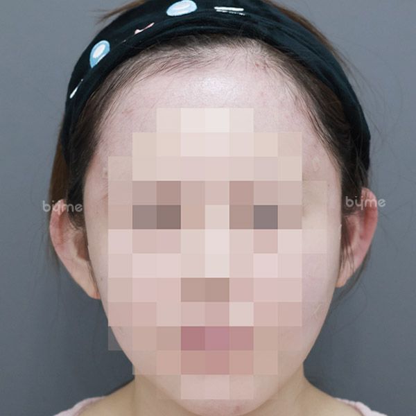 귀필러_니카미 스즈카_후.jpg