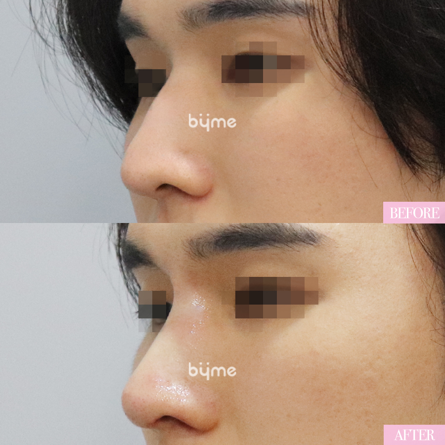 코프팅_이대화_사선.jpg